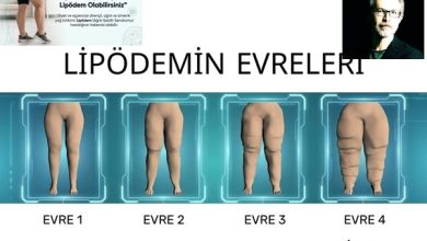 Karacalar, Su İçsem Yarıyor Diyorsanız Lipödem Olabilirsiniz